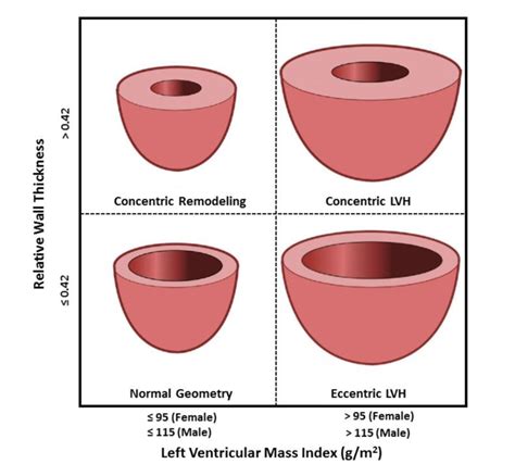 Relative Wall Thickness Calculator.